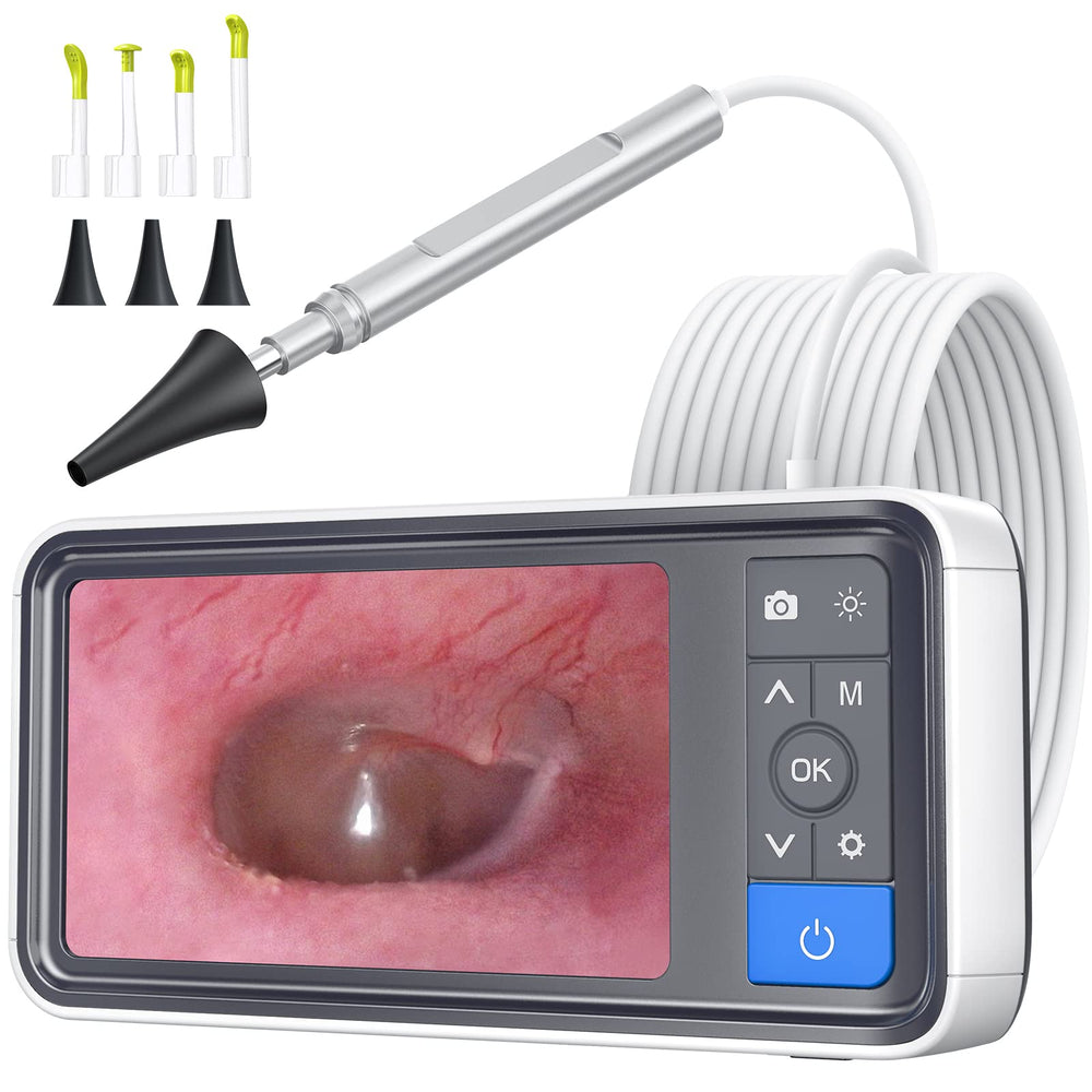 ScopeAround otoscope ear-camera with 4.5-inch screen for clear at-home ear checks.