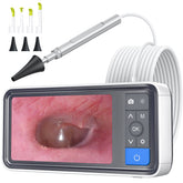 ScopeAround otoscope ear-camera with 4.5-inch screen for clear at-home ear checks.