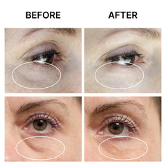 SEAMANTIKA Eye Cream application tap—gentle dab provides firming lift without mess