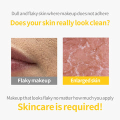 Texture close-up of Secret Key Lemon Sparkling Gel highlighting gentle exfoliation