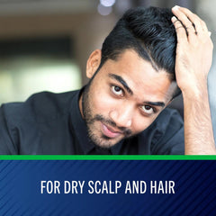 Selsun Blue Aloe bottle against scalp-relief context for dandruff management.