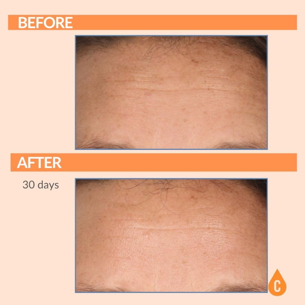 Serious Skincare Hydration supports smoother skin texture and plumpness