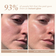 SHANI DARDEN Kaolin mask neutralizing after-peel residue for clearer-looking pores.