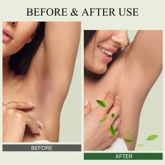 SHVYOG Underarm Detox Scrub green tea—refreshing cleanse with odor control.