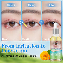 sinBron Eyelid Drops application provides calming relief on contact.