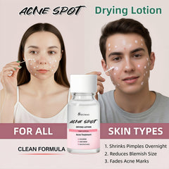 Siruimao drying lotion swab applying precise spot treatment.