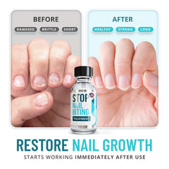 SISQUOC HEALTHCARE Stop Nail Biting kid use shows kid-friendly, safe deterrent polish.
