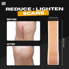 Skin Grip scar tape long roll provides extended scar coverage