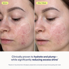 Skinfix refill packaging highlights eco-friendly 1.7 oz refill option