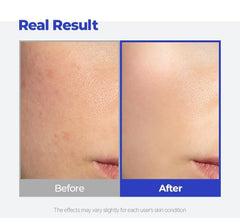 SKINSINS No-white-cast sun gel on skin emphasizes breathable, comfortable wear