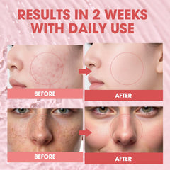 Close-up of SKSOYT Pink Peptide 12 PDRN Serum texture for light absorption