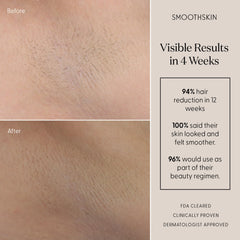 SMOOTHSKIN SmoothSkin Pure Mini underarm treatment during everyday grooming