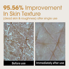 Rice-ceramide formula in SOME BY MI Galactomyces Glutathione Brightening Cream strengthens the barrier.