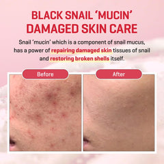 SOME BY MI Snail Truecica Cream ingredients graphic highlighting snail mucin and ceramides for moisture.