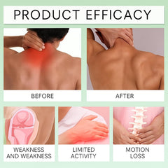 SPIANEST NMD Arnica Cream Application demonstrates fast-absorbing soothing care.