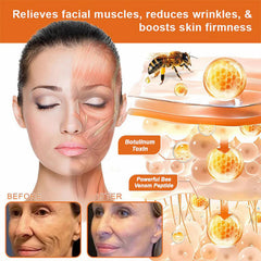 SpzV APKAPK Bee Venom with shea butter and hyaluronic acid delivers deep moisture