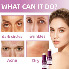 STDKDFW Calcium Multi Balm eye-area application highlights gentle, non-greasy care