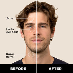 Stryx Concealer Stick twist-application delivers precise, controlled coverage.