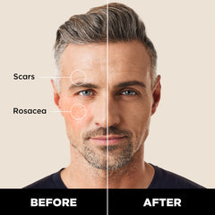 Dab and blend action on the face with Stryx Concealer Tool