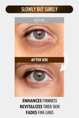 SUR.MEDIC+ 24K Gold Perfection hyaluronic acid reveals multi-layer hydration.