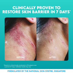 Suu Balm Intense Itch Relief Cream open tub highlighting non-greasy absorption.
