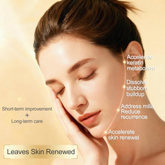Direct spot application on a milia with Sylvirene serum