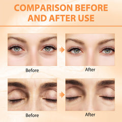 Tbexem Revive Glow eye balm brightening effect to even skin tone and enhance glow.