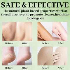 Tea Tree Soap relief bar wet hands demonstrates cleansing and refreshing feel.