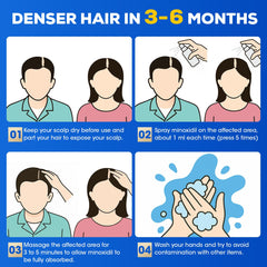 TEADZ Minoxidil beard growth usage on facial hair