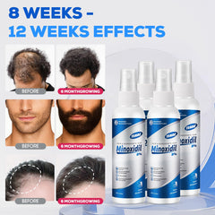 Contains castor oil, aloe vera, rosemary for scalp nourishment