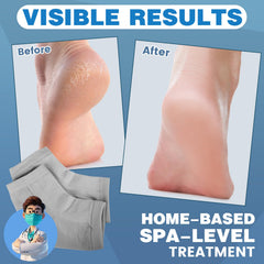 TEAWOO moisturizing heel socks black reduce friction and protect heels during wear.