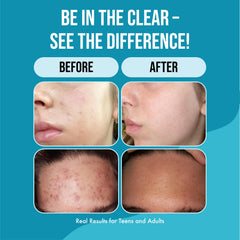 Natural extracts in Teenology Shampoo Mint support skin and hair care.