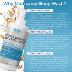 Terramed Eczema Body Wash with scrubber brush included for gentle exfoliation.