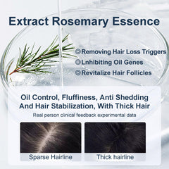 Tgideas anti-hair-loss formula bottle illustrating root-strength against shedding