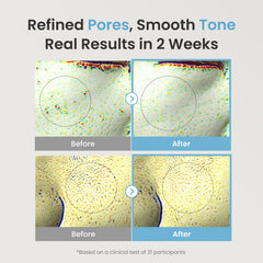 The Face Shop Alltimate Niacinamide 10percent Serum texture for smooth absorption.