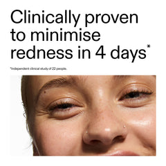 The INKEY List Azelaic Acid 10% Serum pump dispensing a small droplet.