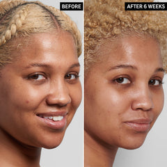 Close-up texture of The INKEY List Niacinamide Serum showing lightweight consistency.