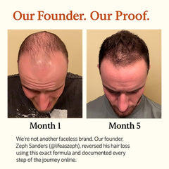 Dropper tip dispensing The Mane Elixir Blend onto thinning areas for precision