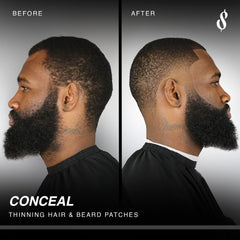 The application card guiding precise placement around the hairline.