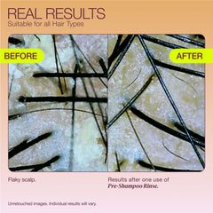 THE ROOTIST Pre-Shampoo massaging on scalp demonstrating gentle exfoliation
