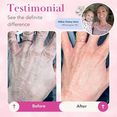 Theraplex Clear Emollient Lotion ideal for sensitive skin with fragrance-free formula.