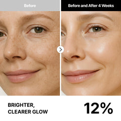 THOME G-Peel Kit Refine step closeup highlights prep for brighter, refined texture.