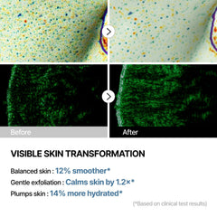 THOME G-Peel soothe step calms sensitive skin during treatment.