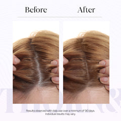 Thorn & Berry application ritual promotes refreshing scalp feel