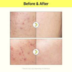 TIAM Vita B3 Source Serum applied on face during morning routine for glow