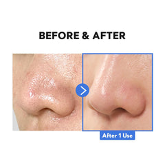 TIRTIR Hydro Boost balm leaves skin smooth and hydrated thanks to the enriched complex.