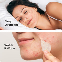 TKTK 10mm spot patch ideal for mid-sized breakouts.