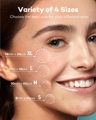 TKTK Pimple Patch 10mm size designed for larger blemishes.