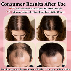TNEGHC spray applied to scalp for even coverage.