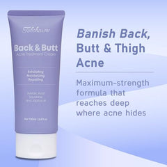 Tobcharm Chest Acne Skin Clarifying Cream helps even tone on chest